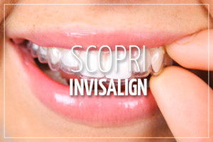invisalign